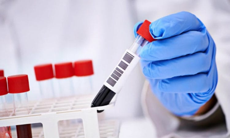 Фото: sosud-ok.ru