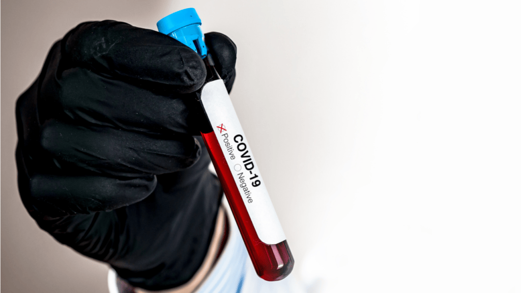 В Алматы выявлено 10 новых случаев заражения коронавирусом