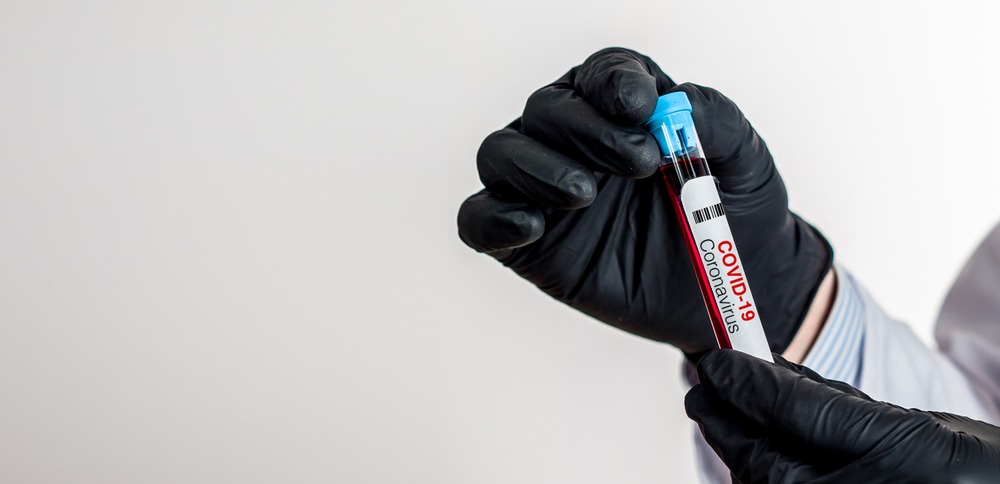 Фото: Shutterstock