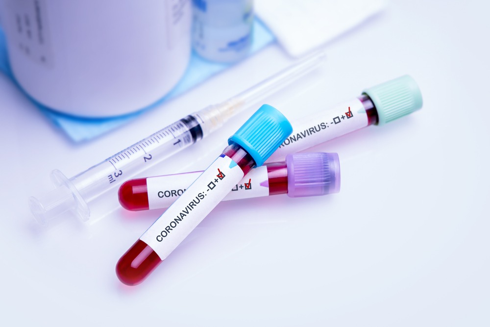 Фото: Shutterstock