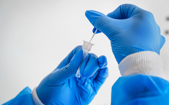 АҚШ-тың бас инфекционисті омикрон штаммының ерекшеліктерін атады