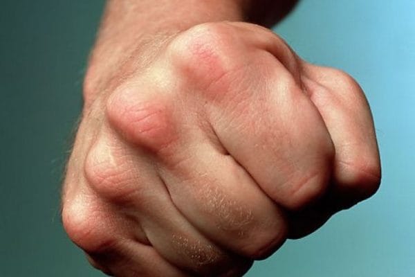 В Риддере избили отца парня, погибшего под колесами авто замакима