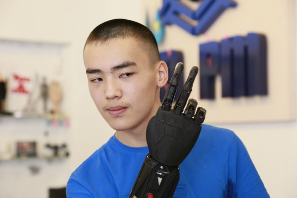 В Казахстане впервые спроектировали и установили бионический протез руки