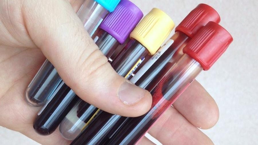 Допинг-пробы 6 казахстанцев на ОИ-2008 вызвали подозрения