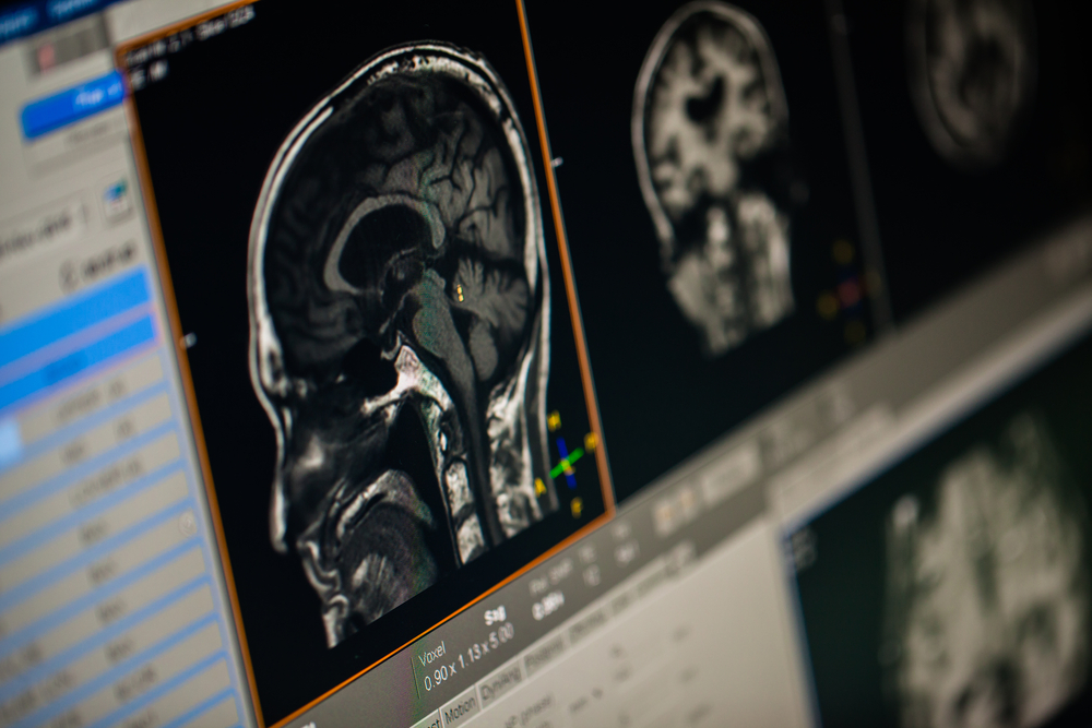 В Балхаше по программе ГЧП откроют кабинет МРТ