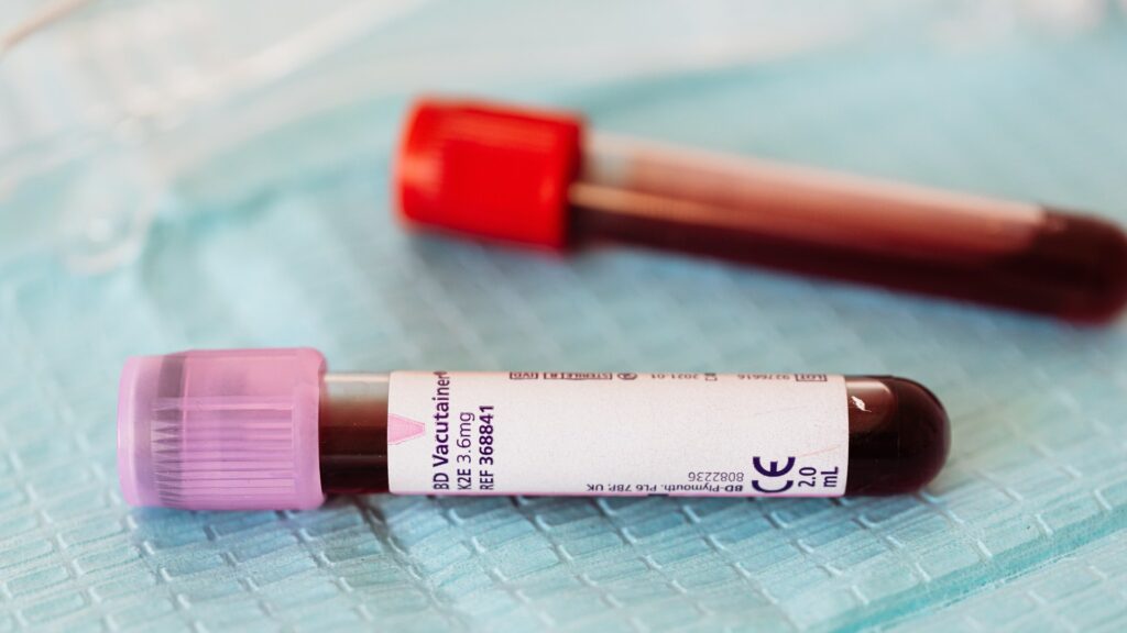 Коронавирус: бір тәуліктер 1508 адам вирус жұқтырған