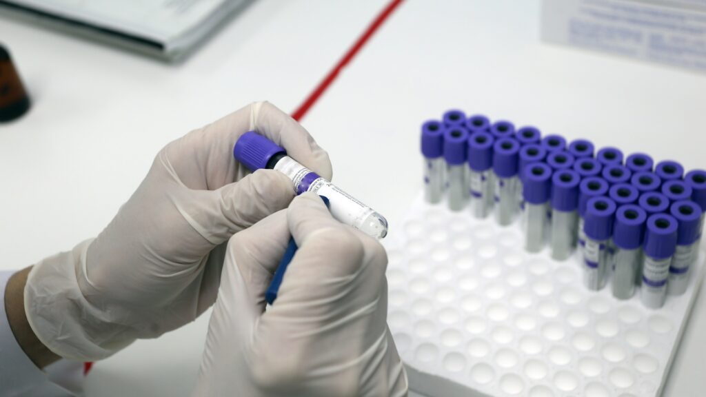 Kazakhstan prepares for a new potential wave of COVID