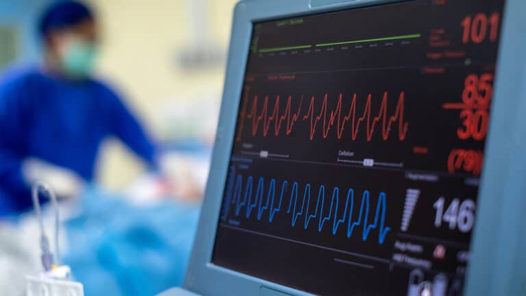 Акции разработчика кардиотехнологии упали из-за превысившего прогноз убытка