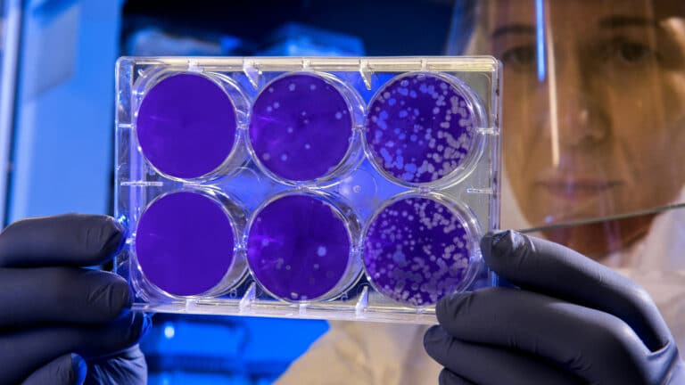 Flesh-eating bacteria cases rising along U.S. coastlines