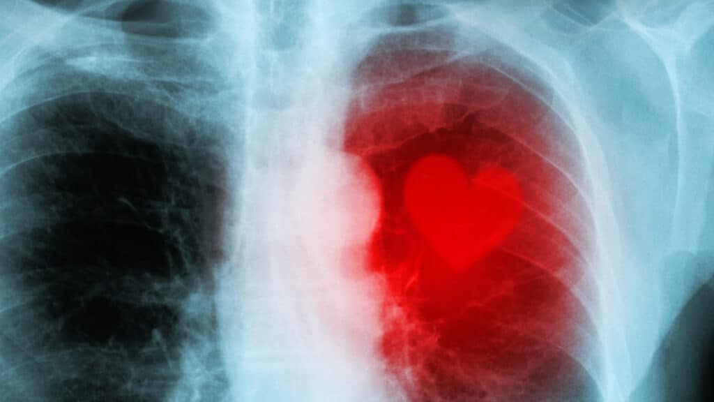 «Адам бір сәтте өліп кетеді»: аритмолог жүрек ырғағының бұзылу салдарын айтты