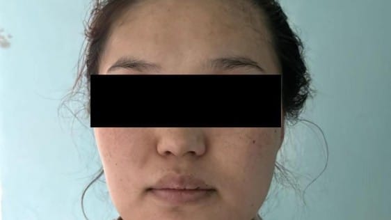 Қоқыс контейнерінен жаңа туған сәбидің денесі табылды