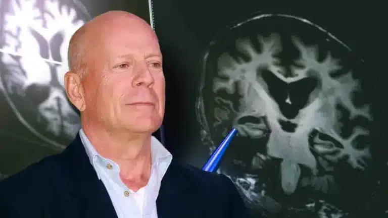 Брюс Уиллистің әйелі күйеуінің миын ғалымдарға беруге дайын