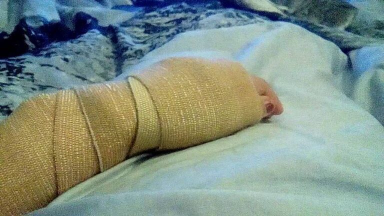 Психолог кабинетінде аутизмі бар қыздың қолын сындырып тастады