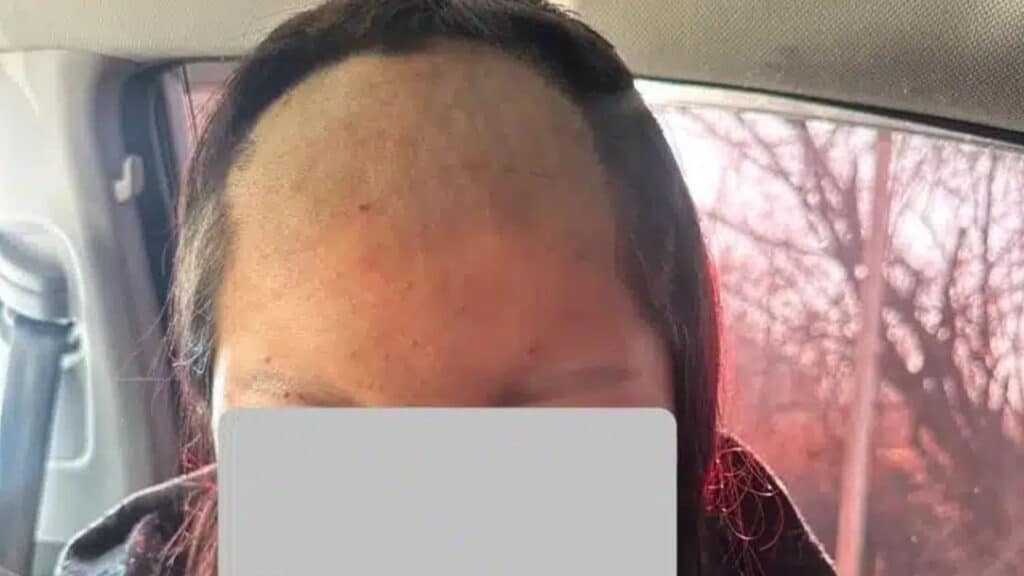 17 жастағы қызды ұрып-соғып, шашын қырып тастаған – фото