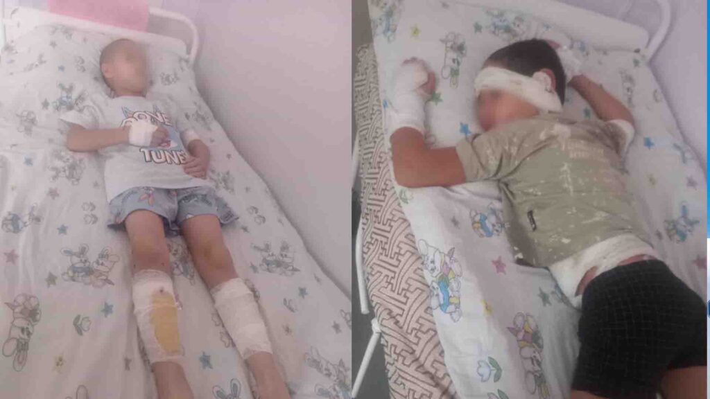 Шымкентте әйел балаларының денесіне үтік басып, шашын тақырлап тастаған