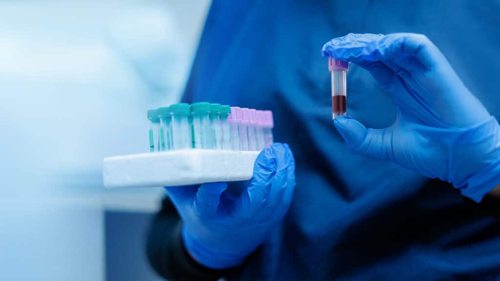 Banner Veterinary clinic laboratory, blood sample analysis by gloved technician.