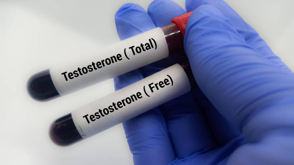 Doctor  holding a test blood sample for Testosterone (Total) and Testosterone (Free) - test. Laboratory medical testing concept. .