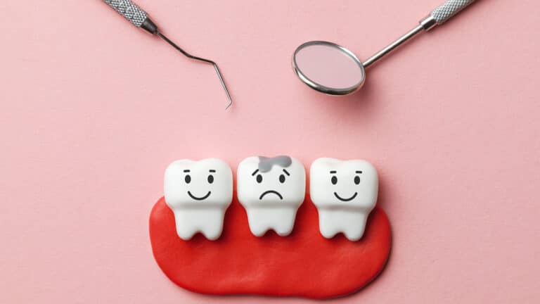 Почему возникает кариес и является ли он инфекцией?