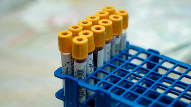 Почему результаты анализов иногда бывают ошибочными