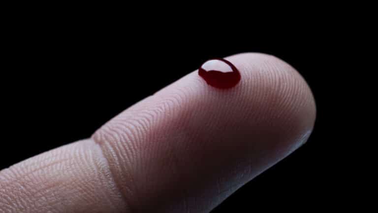 Основные причины «густой крови» и стоит ли беспокоиться