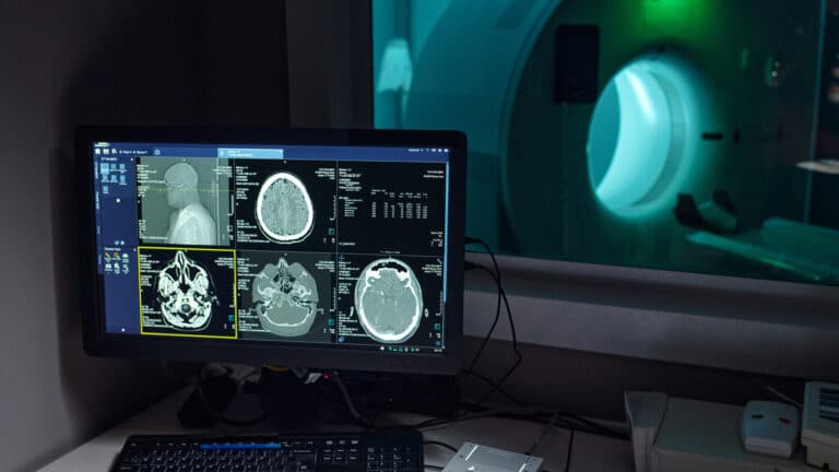 Чем МРТ отличается от КТ и что из этого лучше?