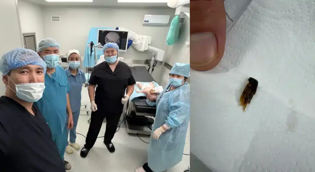 Ақтауда шемішке шаққан бала операциядан бір-ақ шықты