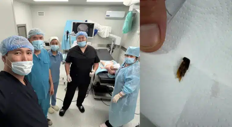 Ақтауда шемішке шаққан бала операциядан бір-ақ шықты