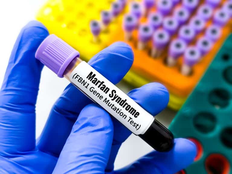 Финансирование лечения редких болезней в Казахстане достигло рекордных 175 млрд тенге