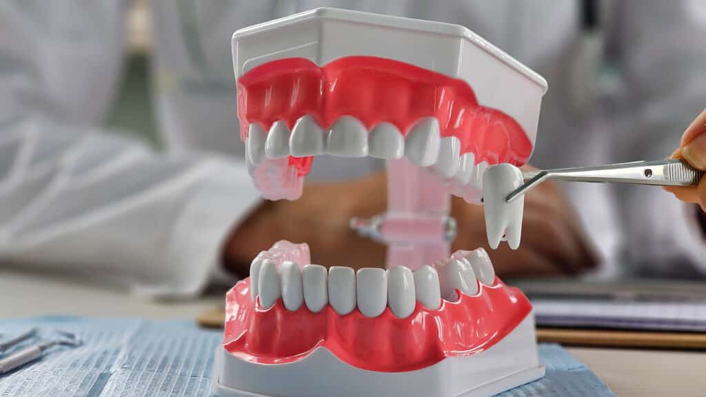 Dentist pulling tooth with forceps out of jaw model. Dental surgeon using instrument for teeth removal, extraction. Stomatology, oral health problems