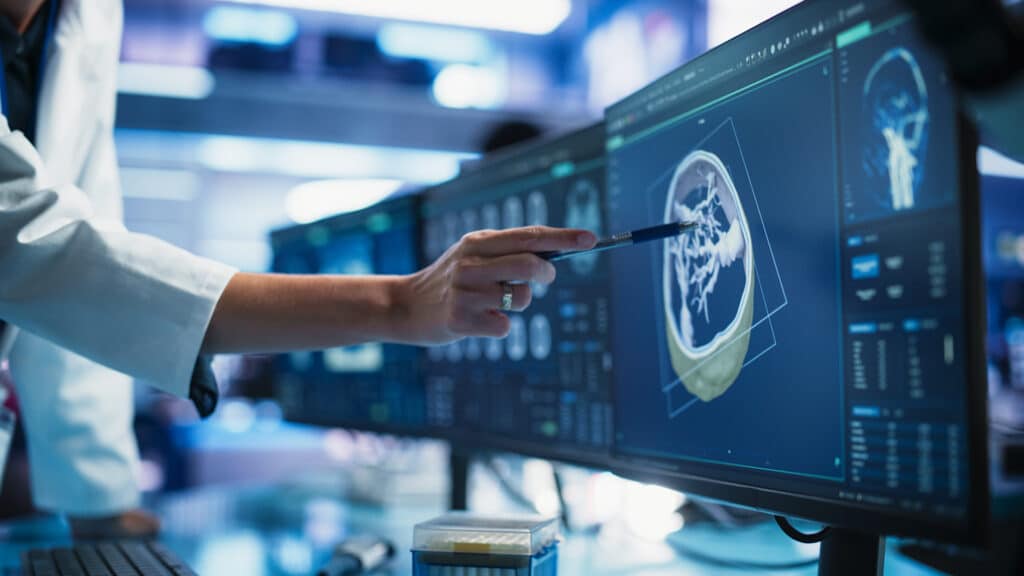 Modern Cancer Research Medical Center: Anonymous Doctor Pointing At Desktop Computer Monitor With 3D Software Visualizing Human Brain Based On CT Scan. Neurologist Looking For Tumor In Patient's Brain