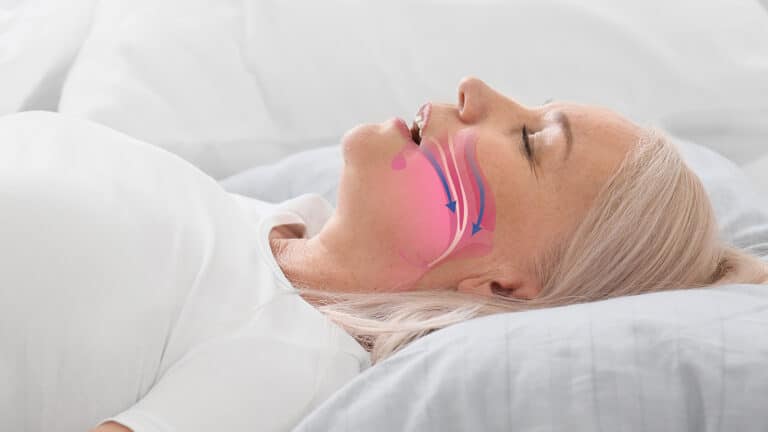 Ученые нашли эффективную таблетку от апноэ сна