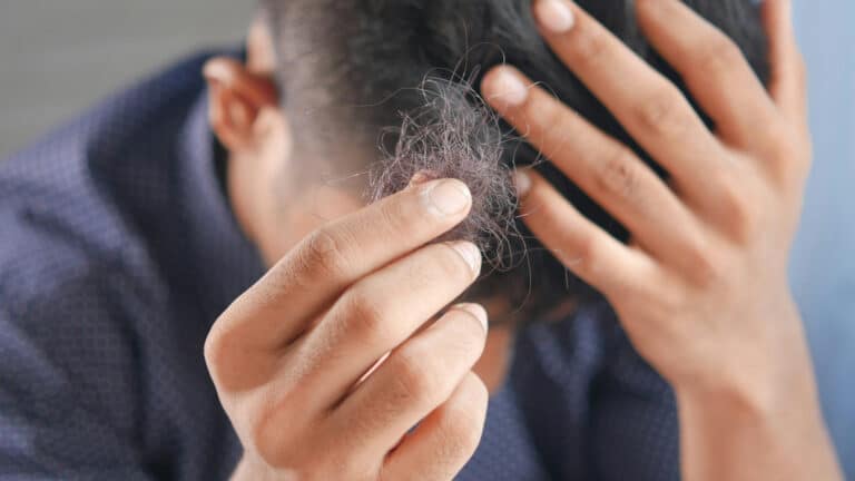 Возможные причины выпадения волос в молодом возрасте 