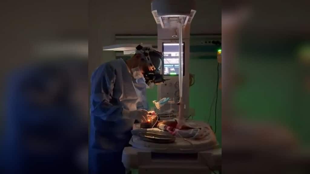 Недоношенной девочке весом 650 граммов прооперировали глаза в Шымкенте