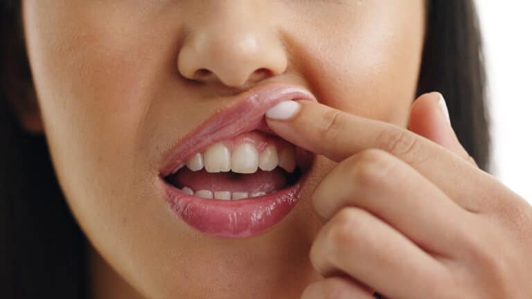 Ученые создали искусственную слюну, которая защищает зубы от кариеса