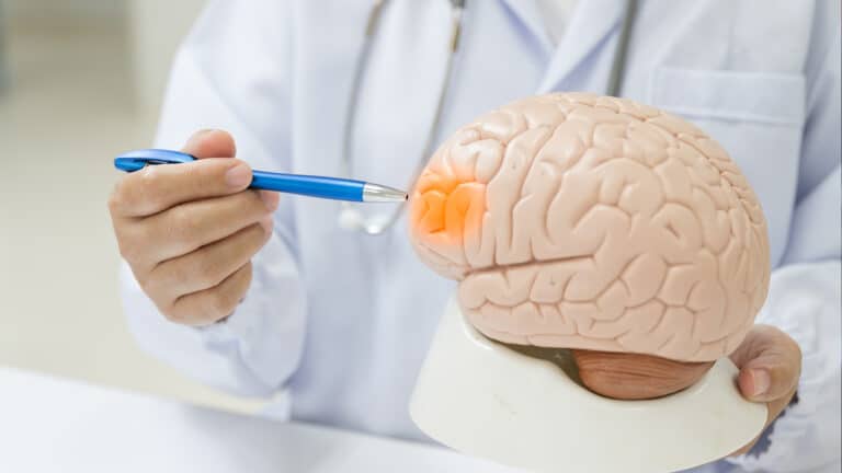 Ученые выяснили, что длительный прием бета-блокаторов после инсульта нужен не всем 