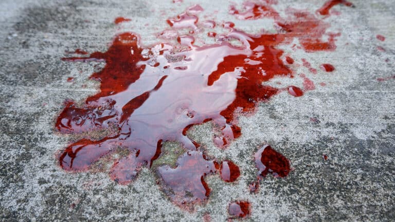 Возможные причины рвоты с кровью