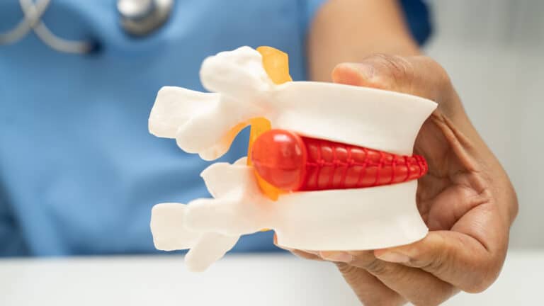 Всегда ли нужна операция при грыже межпозвонкового диска