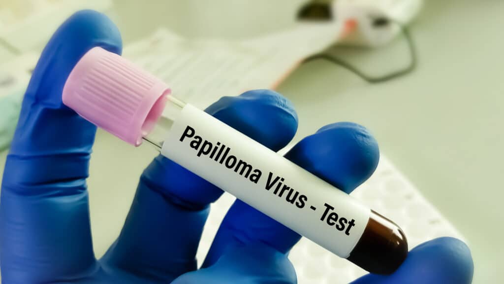 HPV VIRUS (Human Papillomavirus) on tube , medical and health care concept.