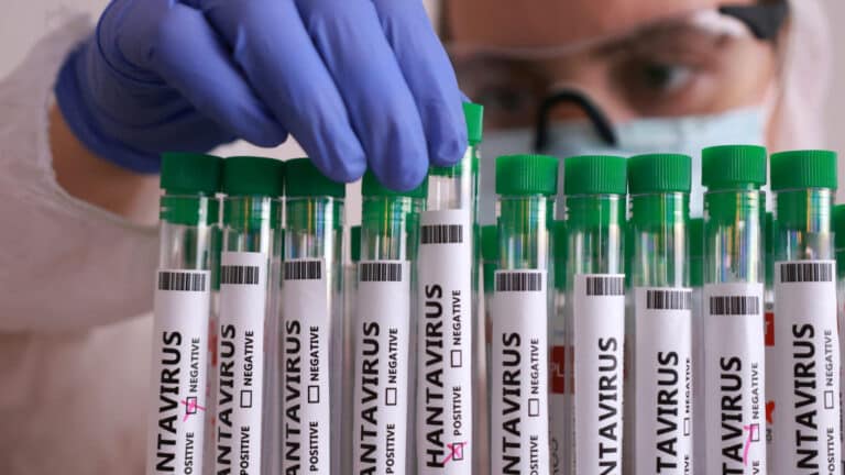 Что нам известно о хантавирусе сейчас и стоит ли бояться новой эпидемии