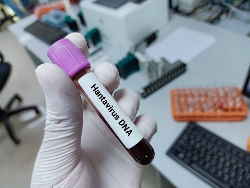 Хантавирус: готовы ли казахстанские медики к возможным завозным случаям