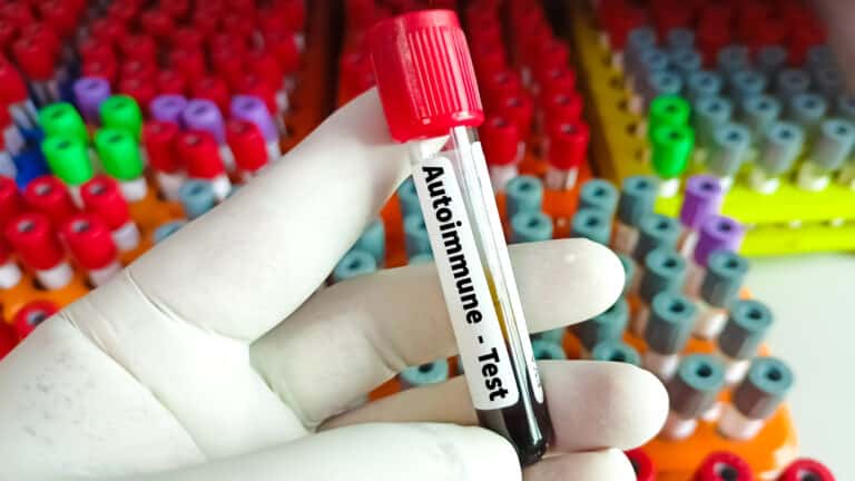 Пациентам с тяжелой аутоиммунной болезнью удалось выйти в ремиссию на 15 лет 