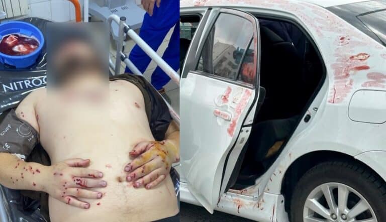 Перестрелка в Мангистау: двое мужчин получили тяжелые огнестрельные ранения
