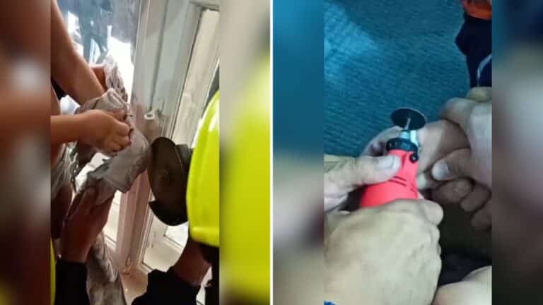 Спасатели освободили палец ребенка из металлического кольца в Кокшетау
