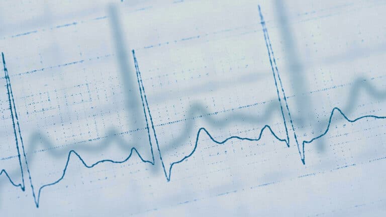 Kazakhstan tests AI for early detection of heart failure